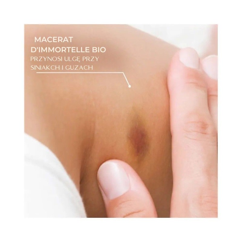 Macerat z kocanki łagodzi stłuczenia