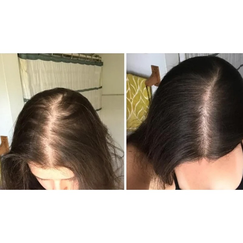 efekty kuracji wzmacniającej maską powder